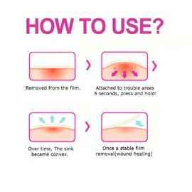 OLIVE YOUNG 1 Pack Care Plus Spot Patch 84ea (10mm 60ea + 12mm 24ea) - Acne Spot Pimple Absorbing Cover Patch, Moist Wound Dressing for Skin Trouble Acne Pimple Care Hydrocolloid Patch