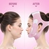 JenChrysm Chin Strap For Sleeping - Jawline Shaper with 3D