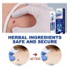 Crema Remove Verrugas,elimina Verrugas Corporales Y Faciales