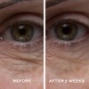 ELEMIS Peptide⁴ Eye Recovery Cream, Reviving Eye Cream, 0.5 fl.