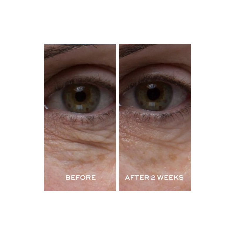 ELEMIS Peptide⁴ Eye Recovery Cream, Reviving Eye Cream, 0.5 fl.