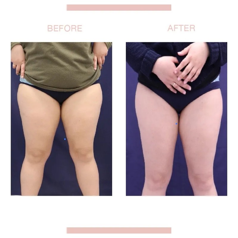 Pb Serum Pbs Draining Power Microemulsion 150ml