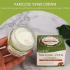 50 Ml De Pomada For Varices Elimina Las Estrías Rojas