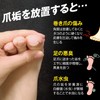 Como Life Nail Plaque Remover R for Winding Nails, Nail