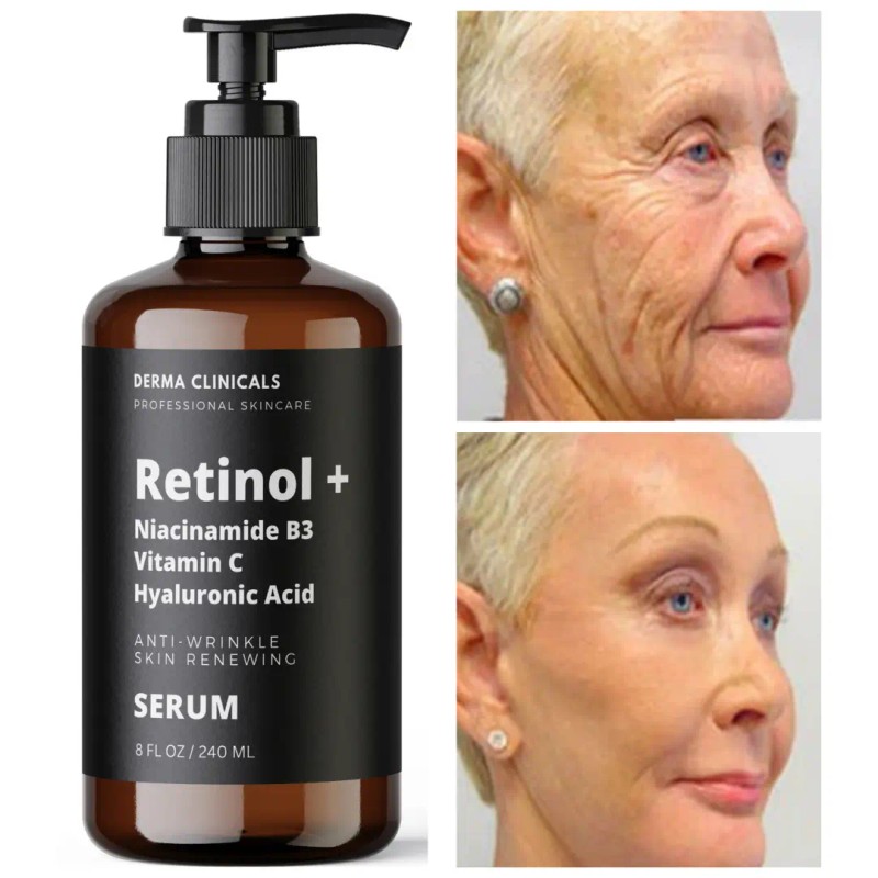 DERMA CLINICALS 8oz - Retinol, Niacinamide, Vitamin C, Hyaluronic Acid,