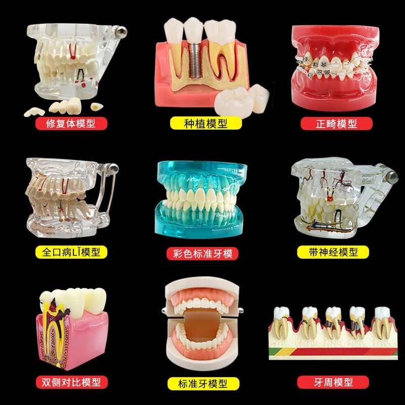 DentiForm 덴티폼 모형 위생사 재료상 모양 임플란트 기공사 입모형 [사배분해모형