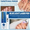 Bolígrafo Láser Hot Nail Fungus Pen Con Luz Azul