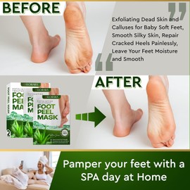 Foot Peel Mask, 2 Pack, Exfoliating Dead Skin and Calluses for Baby Soft Feet, Smooth Silky Skin, Repair Cracked Heels Painlessly, Leave Your Feet Moisture and Smooth (Aloe Vera)