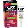 OXY Acne Medication Maximum Action Spot Treatment 1 Ounce (Value
