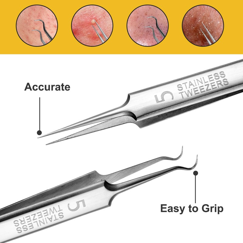 Pimple Blackhead Remover 3-Piece Tweezers Face Nose Black Head Precise