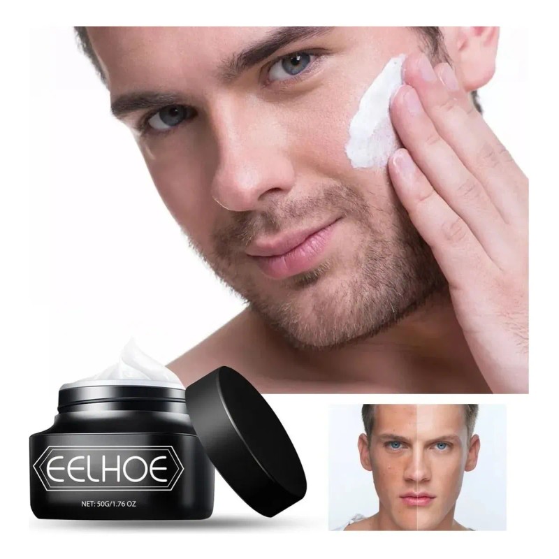 Crema Correctora Eelhoe Para Hombres Con Marcas De Acné Pere