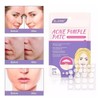 48 Parches Acne Dia/ Noche Quita Acne Espinillas Tapa Acne