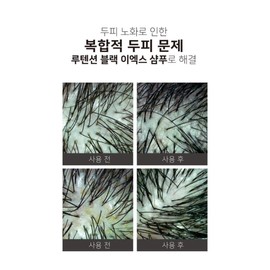 The Cera Lutension Black EX Shampoo 500ml Hair Loss Prevention Black Bean / 더쎄라 루텐션 블랙EX샴푸 500ml 탈모방지 검은콩