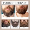 Q. Cosméticos Rapolo Para Barba, Estimulante Barba1.eq1h