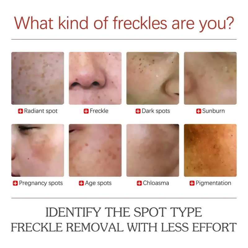 Hidratante Facial Eelhoe Para Hidratación Y Suavidad Diarias