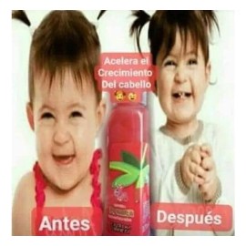 Shampoo Sandia Shelo Nabel 500ml Cero Lagrimas Niños Pack