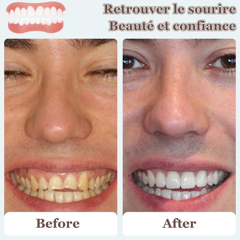 4 Pairs Dentures Cosmetic Smile Dentures Instant Scettar Plating Teeth