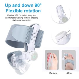 KARELLS Hallux Valgus Korrektur, Hallux Valgus Korrektur Set für Damen und Herren, Upgrade Version Mit Verstellbarer Schiene und Silikon Zehenspreizer für Daumen Zehen Tag und Nacht Unisex Grau