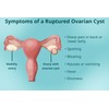 supplements4me REMOVAL CYST FREE - TO TREAT & PREVENT Made