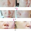 ENCOS Arbutin Alpha Melasma Pigmentation Whitening Cream 15ml 2+1 [56%]