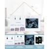 GOZINA Baby Scan Photo Frames with Baby Handprint and Footprint