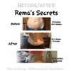 Rema's Secrets Seaweed Dead Sea Body Wraps Fat Melting Lipo