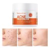 Crema Facial De Acné, Tratamiento Con Acné Quístico De Ácido