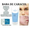 Pack Crema Facial Baba Caracol Jabon Shelo Nabel