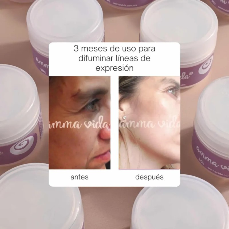 Crema Extra Nutrición Amma Vida, Nutre Tu Piel Y Humecta