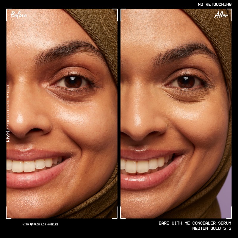 NYX Professional Makeup Concealer Serum, Combats Dark Circles, Acne, Redness