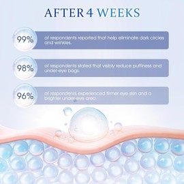 Valentine's Gift for her-Retinol Under Eye Cream - Anti Aging Eye Cream for Dark Circles and Puffiness, Eye Bags, Wrinkles Fine Lines Skin Care Treatment Hydrates Moisturizes (0.67 Fl Oz)