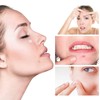 Rpanle Acne Patches[180 Pcs], Invisible Hydrocolloid Spot Patches, Dots for