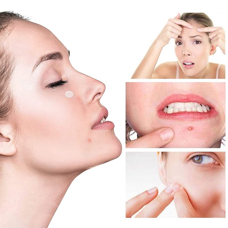 Rpanle Acne Patches[180 Pcs], Invisible Hydrocolloid Spot Patches, Dots for