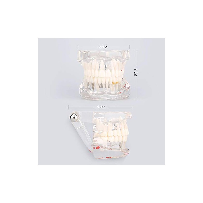 Modelo de dientes, modelo de práctica de enseñanza de dientes