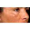 Despigmentante Loobayan Light Tone H 30ml Manchas Melasma