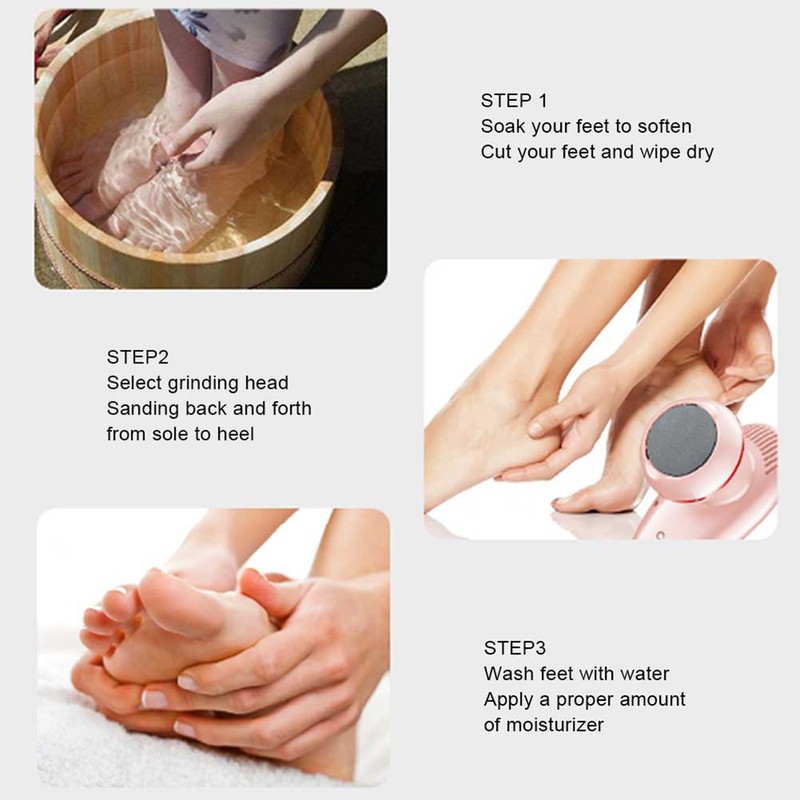 MARSKE Electric Feet Callus Removers Grinder Portable Foot File Pedicure