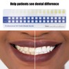 5pcs Teeth Whitening Shade Guide, Tooth Shade Chart Comparing Card,