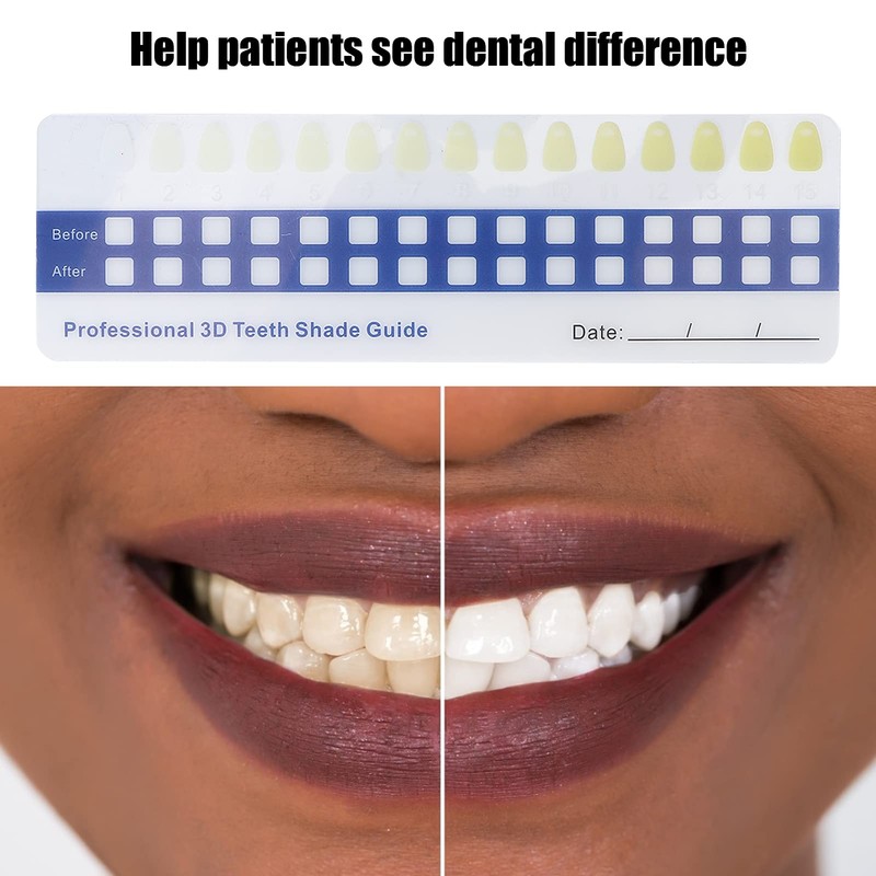 5pcs Teeth Whitening Shade Guide, Tooth Shade Chart Comparing Card,