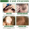 Aceite Natural de Batana para Cabello, Serum Capilar Nutritivo, Tratamiento