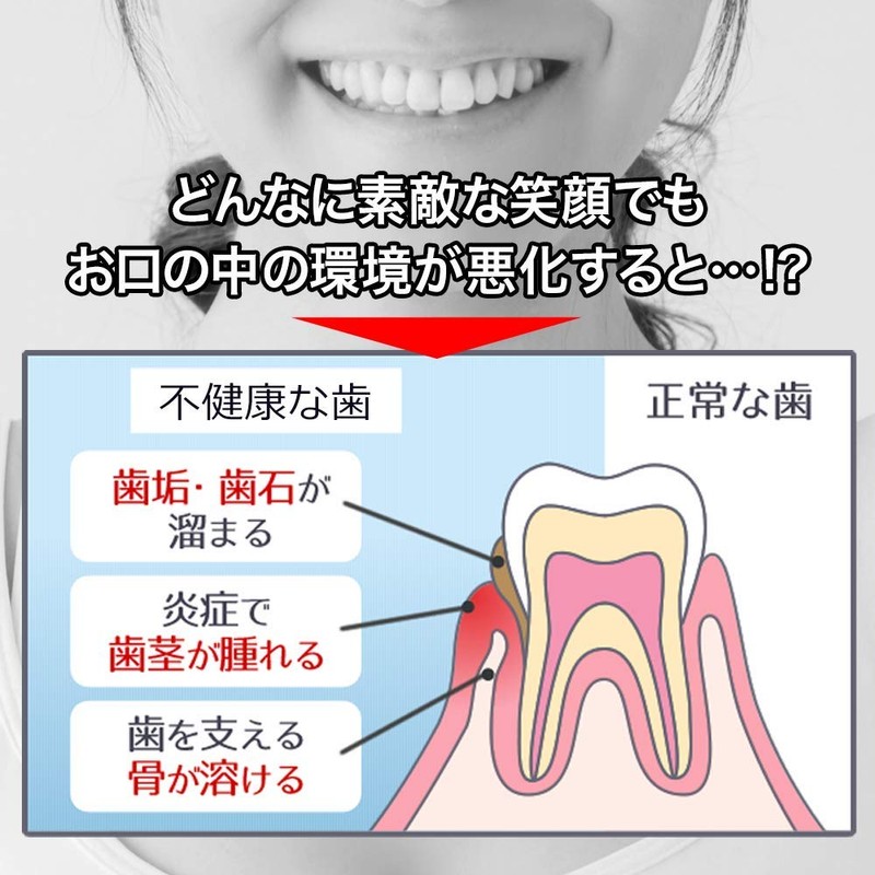Whitening Hinoki Clean Teeth Polishing [Oral Care Refresh] Xylitol 1.6