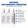 Liquid Oxygen Acne Treatment System for Acne-Prone Skin | Oxygen-Infused