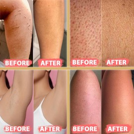 Set of 4 - Kelebek Premium Exfoliating Mitt | Deep Cleansing Bath Gloves for Women and Man | Natural Turkish Hammam Keesa for Body Scrub & Dead Skin Removal (Medium-Textured)