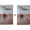 See detailed description Shard Eye Bag Lift 1100 Shots 2