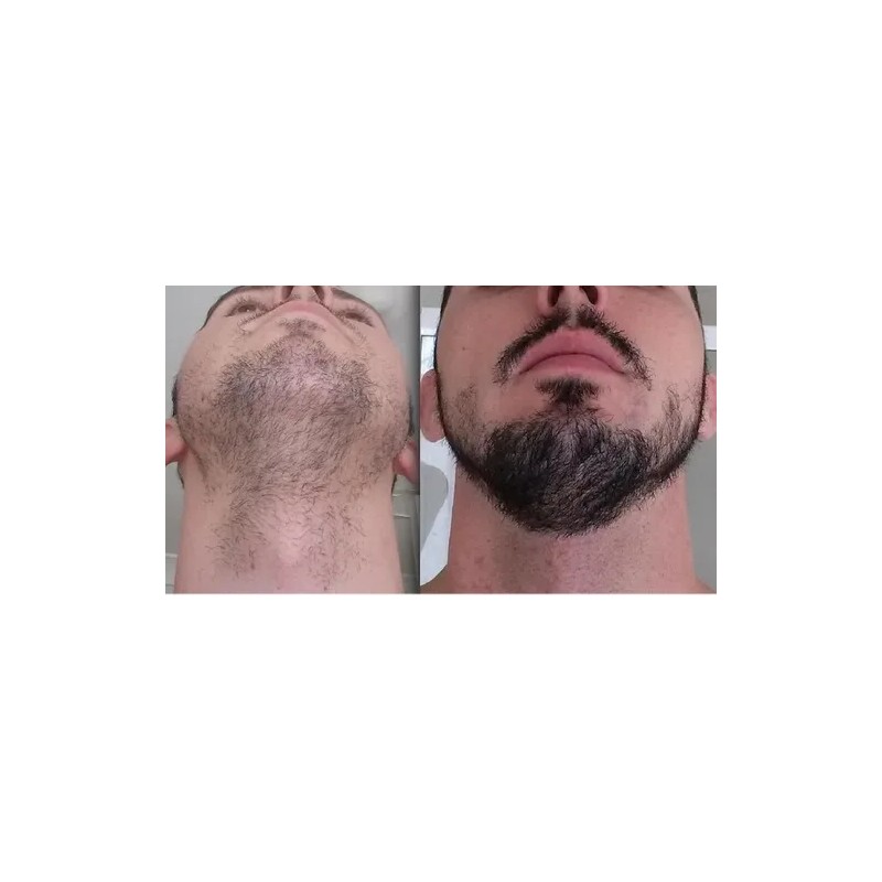 Barba Gel Crema Barba Bigote Barba Oferta Novocrin Barba