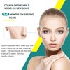 Silicone Scar Sheets, Silicone Scar Tape(1.8” x 157” Roll-4M), Scar
