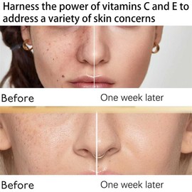 7 - Día Rápido - Crema De Reparación De La Piel, Multi-efecto Crema De Cuidado De La Piel, Reafirmante, Anti-arrugas Y Crema Hidratante Iluminadora, Para Todas Las Edades Y La Piel 50g