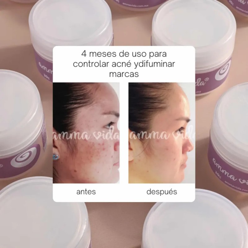 Crema Extra Nutrición Amma Vida, Nutre Tu Piel Y Humecta