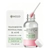 Weud Serum Acne Secado Local Cuidado Facial Piel Skindion