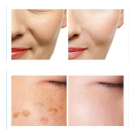 Crema Antiarrugas Milkydeck 377