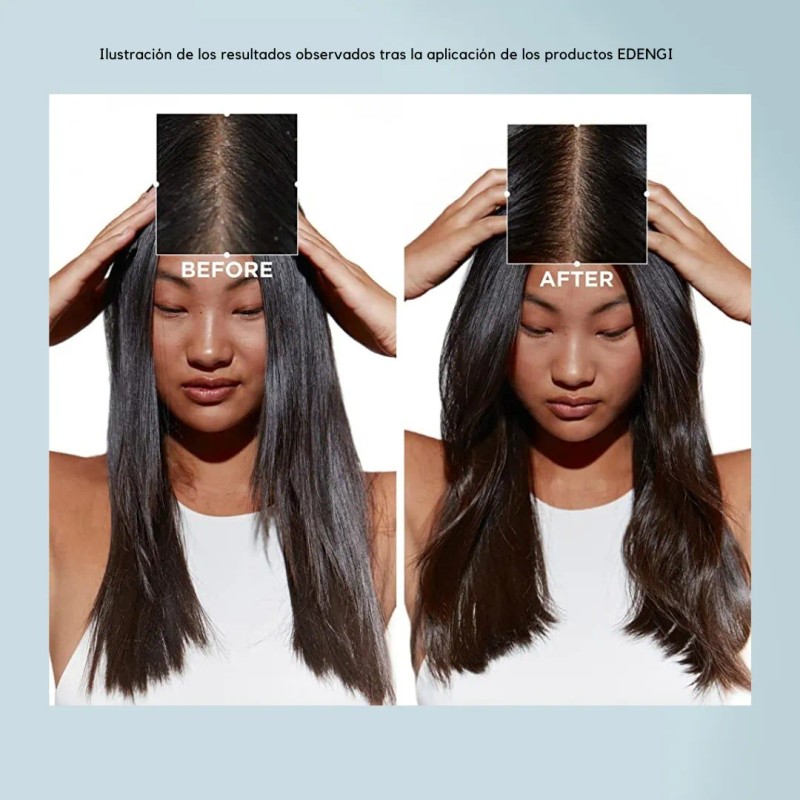 Potente Shampoo Anti Caspa Hidratante Muy Eficaz